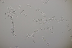 Botryobasidium vagum