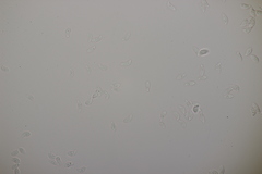 Botryobasidium vagum