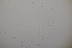 Botryobasidium vagum