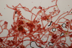 Botryobasidium vagum