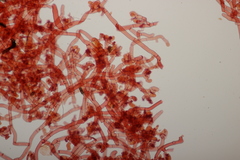 Botryobasidium vagum