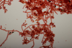 Botryobasidium vagum