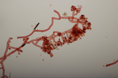 Botryobasidium vagum