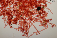 Botryobasidium vagum