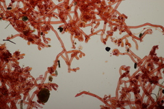 Botryobasidium vagum