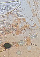 Podospora setosa