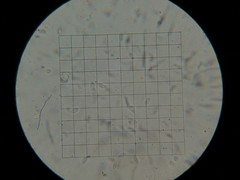 Micromphale arbuticola