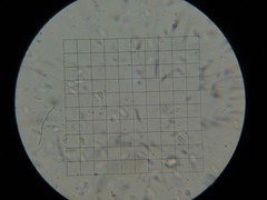 Micromphale arbuticola