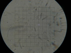 Micromphale arbuticola