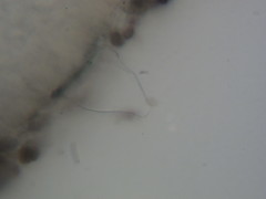 Coprinopsis alopecia