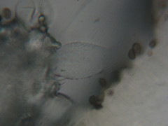 Coprinopsis alopecia