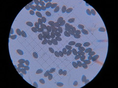 Coprinopsis alopecia