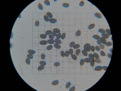 Coprinopsis alopecia