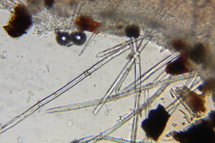 Microstoma floccosum