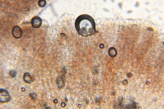 Microstoma floccosum