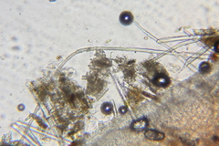 Microstoma floccosum