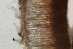 Microstoma floccosum