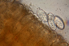 Microstoma floccosum