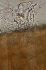 Microstoma floccosum