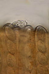 Microstoma floccosum