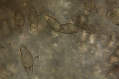 Asterophora parasitica