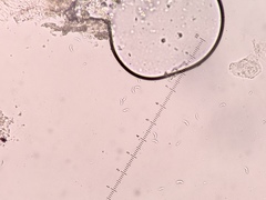 Spirographa pyramidalis