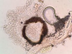 Didymocyrtis melanelixiae