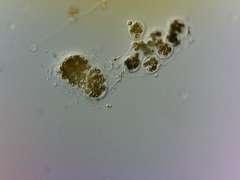 Microcystis wesenbergii