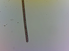 Planktothrix rubescens