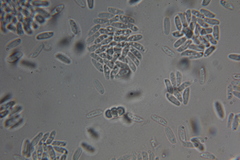 Amylocystis lapponica