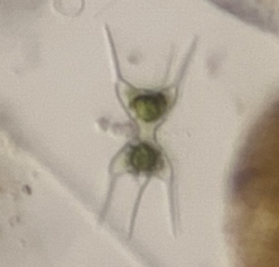 Staurodesmus connatus