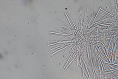 Chlorociboria aeruginascens image