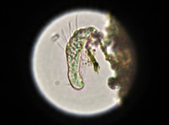 Gastrotricha