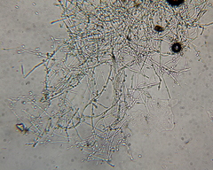 Hypochnella violacea