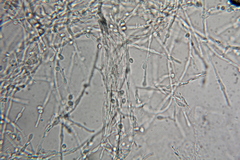 Hypochnella violacea