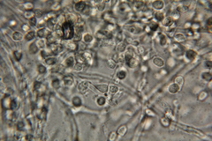 Hypochnella violacea