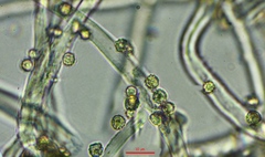 Tulostoma clathrosporum