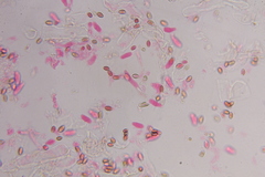 Psilocybe zapotecoantillarum