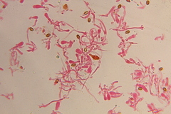 Gymnopilus subearlei