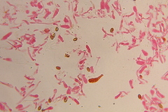 Gymnopilus subearlei