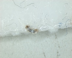 Arthropoda