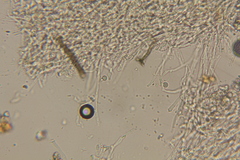 Ophiocordyceps melolonthae