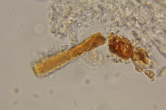 Ophiocordyceps melolonthae
