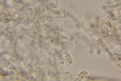 Ophiocordyceps melolonthae