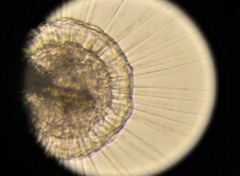 Actinosphaerium