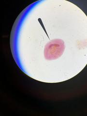 Balantidium