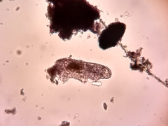 Eutardigrada