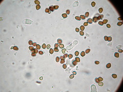 Psilocybe mammillata