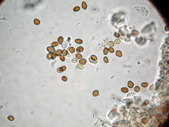 Psilocybe mammillata