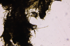 Piloderma